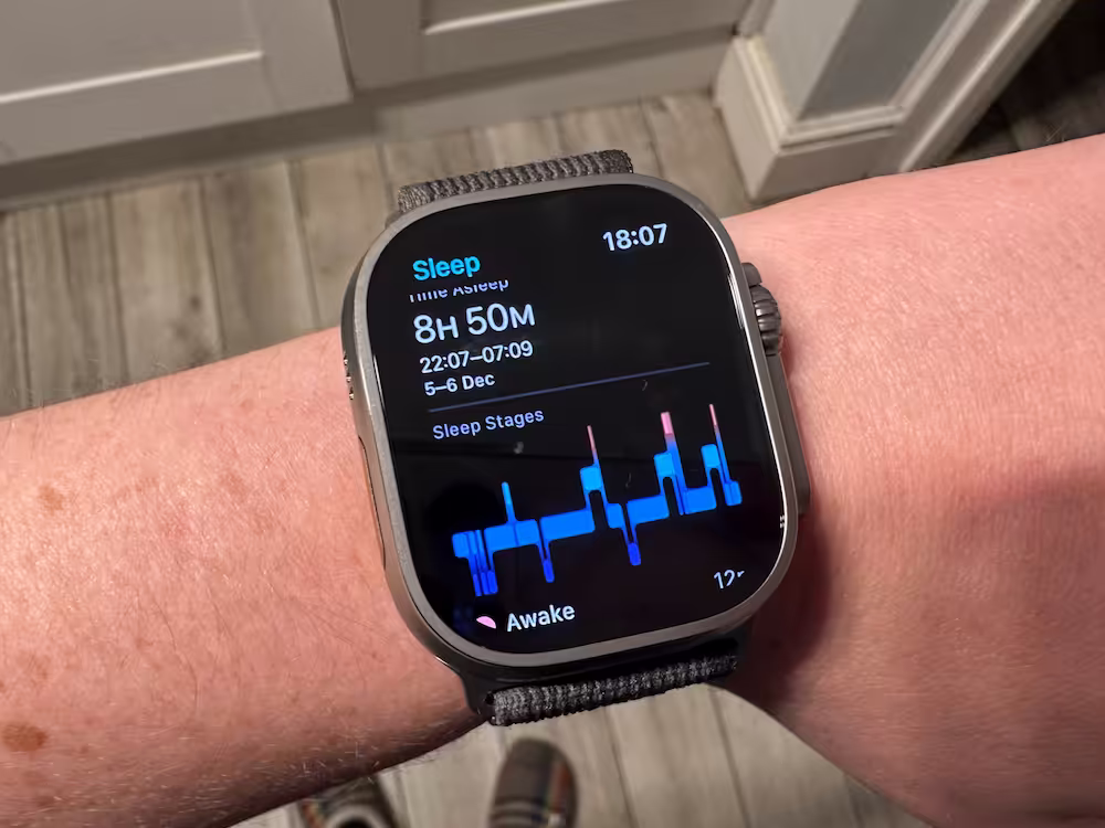 Apple Watch hypnogram